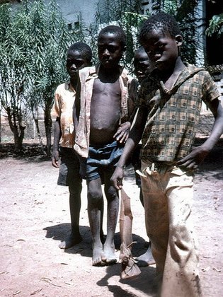 des enfants errant  à la merci de toute sorte de maladies