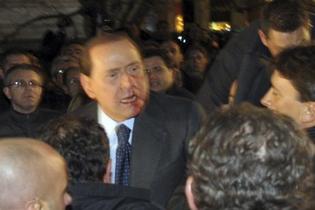 Silvio Berlusconi frappé au visage à l'issue d'un meeting