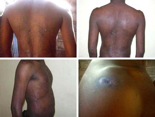 Torture et Liberté d’expression: Le Sénégal épinglé par le rapport d'Amnesty international.