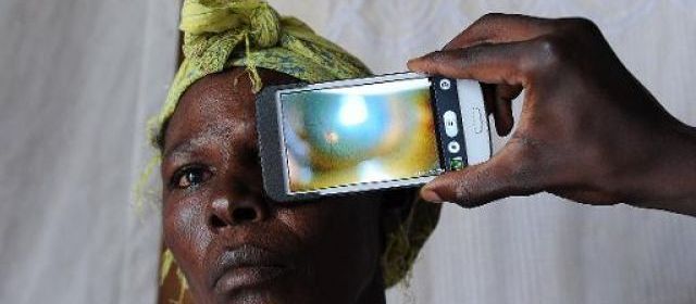 L'"Eye-Phone", outil prometteur de diagnostic oculaire dans les pays pauvres