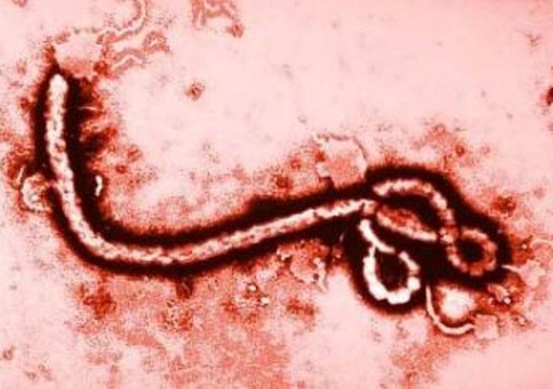 Ebola-Précision de taille de la Direction de la Santé : Comment un sujet atteint peut encore garder le virus trois mois durant