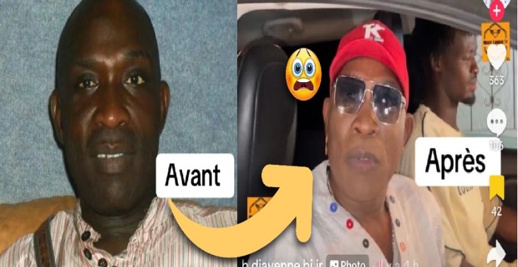 People: teint clair, boucle d'oreille, le Come- back polémique de l'artiste Gorgui Ndiaye