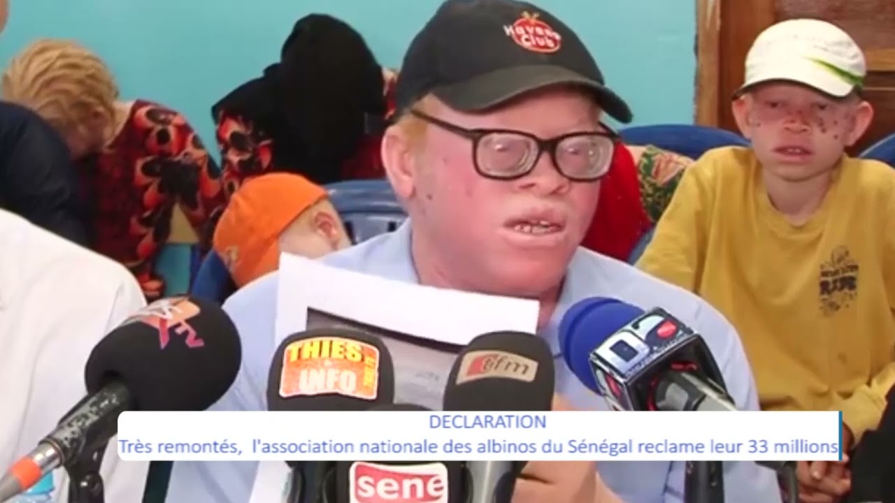 Sénégal : Le président de l’association nationale des albinos détourne 33 millions F CFA